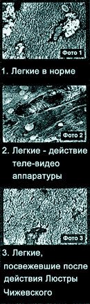 На 3-м фото не белых комочков грязи после воздействия Люстры Чижевского